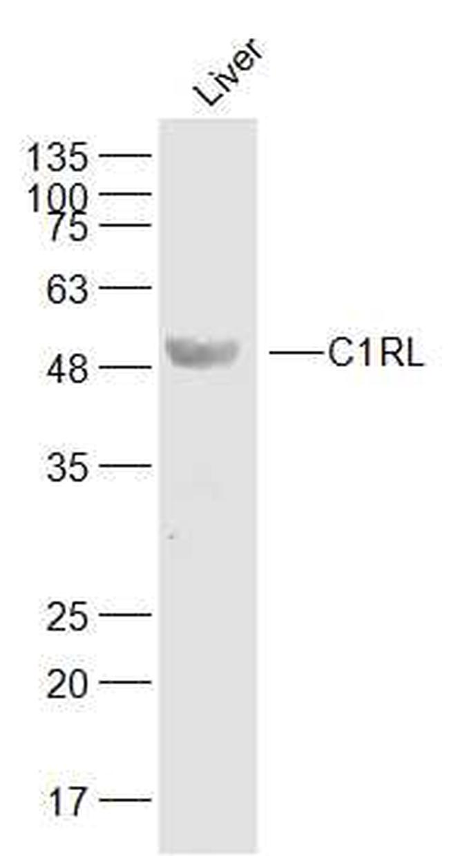 C1RL Antibody in Western Blot (WB)
