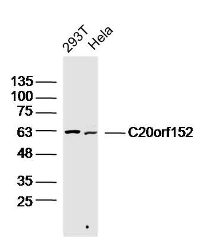 C20orf152 Antibody in Western Blot (WB)