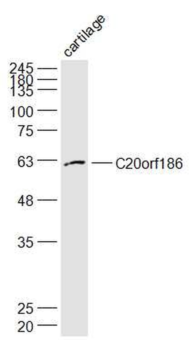 C20orf186 Antibody in Western Blot (WB)