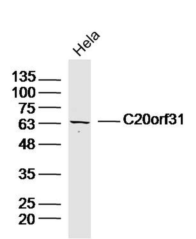 C20orf31 Antibody in Western Blot (WB)