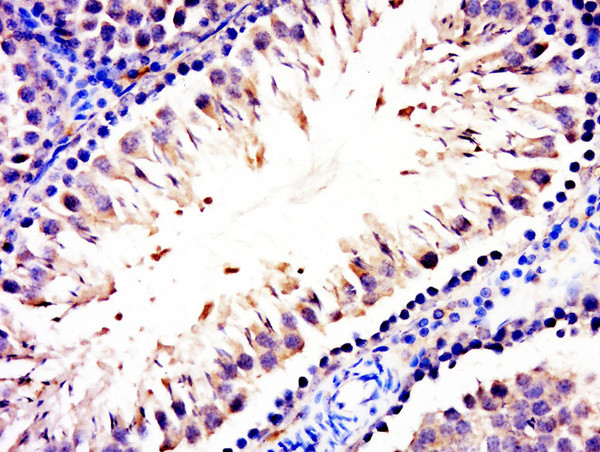 C21ORF13 Antibody in Immunohistochemistry (Paraffin) (IHC (P))