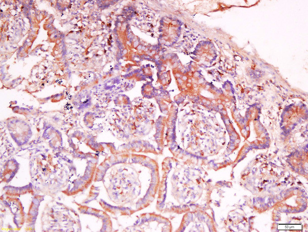 C2orf16 Antibody in Immunohistochemistry (Paraffin) (IHC (P))