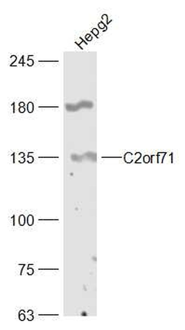C2orf71 Antibody in Western Blot (WB)