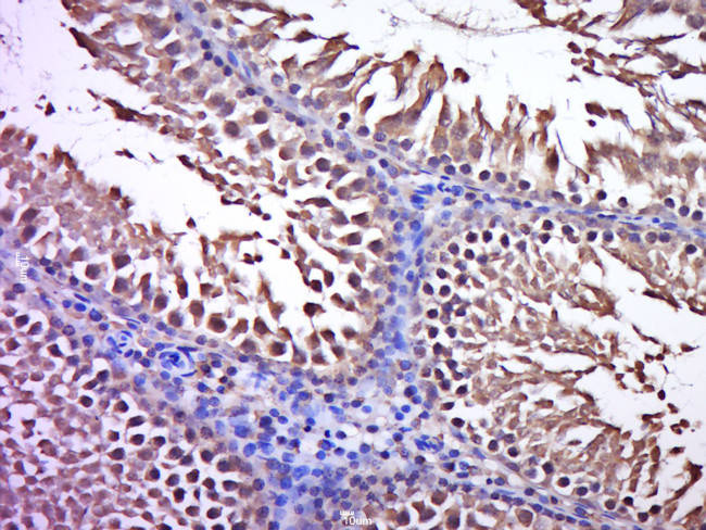 C3orf32 Antibody in Immunohistochemistry (Paraffin) (IHC (P))