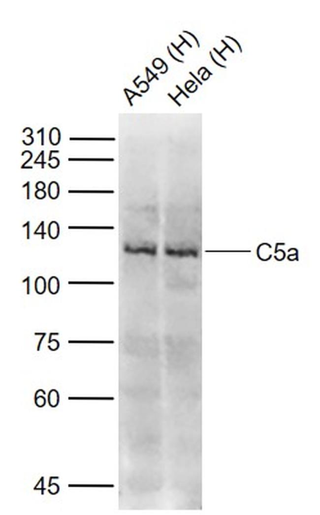 C5 Antibody in Western Blot (WB)