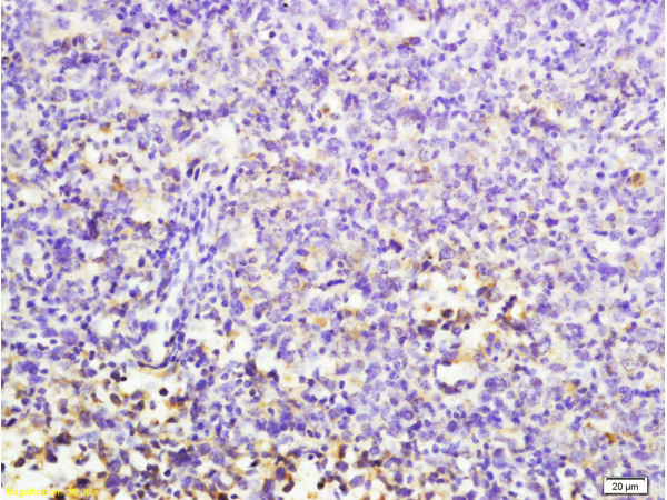 CD7 Antibody in Immunohistochemistry (Paraffin) (IHC (P))