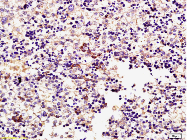 Phospho-ERK1 (Thr183, Tyr185) Antibody in Immunohistochemistry (Paraffin) (IHC (P))