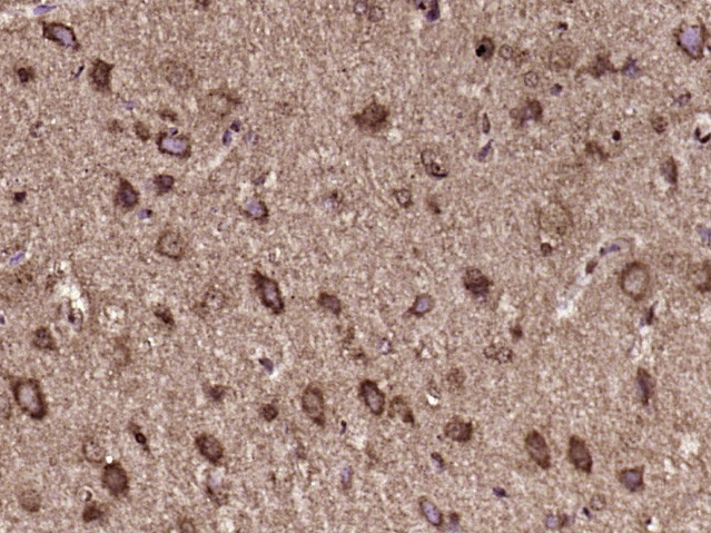C6orf206 Antibody in Immunohistochemistry (Paraffin) (IHC (P))