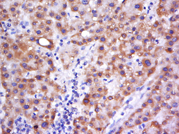 C6orf222 Antibody in Immunohistochemistry (Paraffin) (IHC (P))