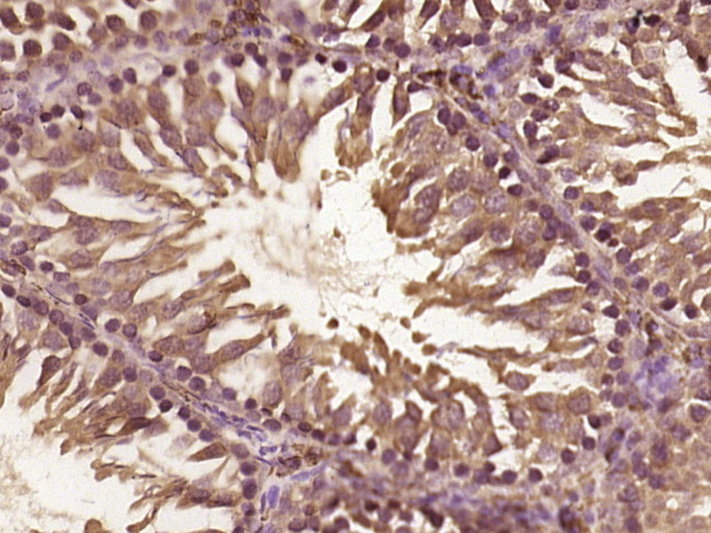 C8orf42 Antibody in Immunohistochemistry (Paraffin) (IHC (P))