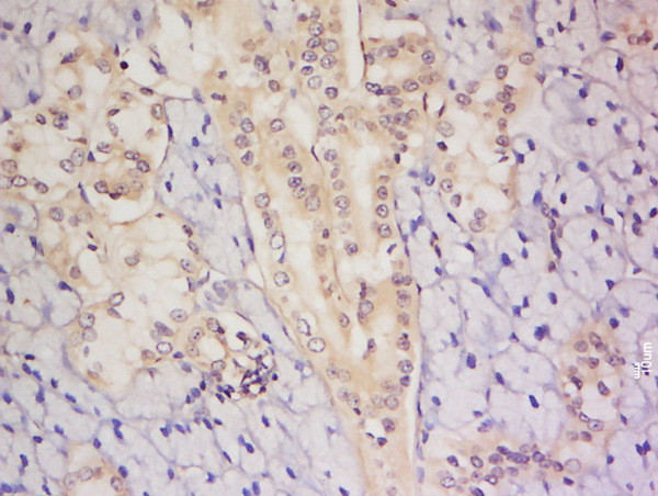 C8orf72 Antibody in Immunohistochemistry (Paraffin) (IHC (P))