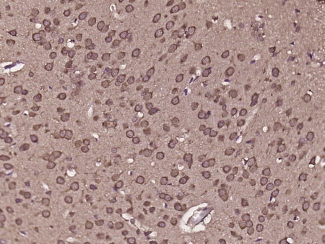 c8orf84 Antibody in Immunohistochemistry (Paraffin) (IHC (P))