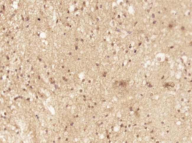 C8orf86 Antibody in Immunohistochemistry (Paraffin) (IHC (P))