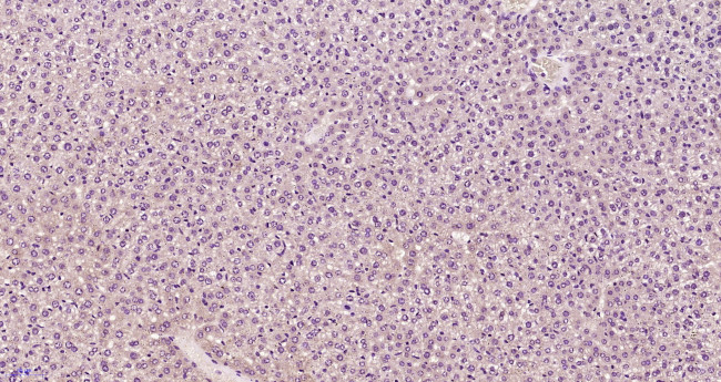 Complement component C9b Antibody in Immunohistochemistry (Paraffin) (IHC (P))