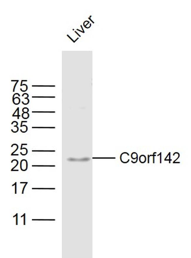 C9orf142 Antibody in Western Blot (WB)