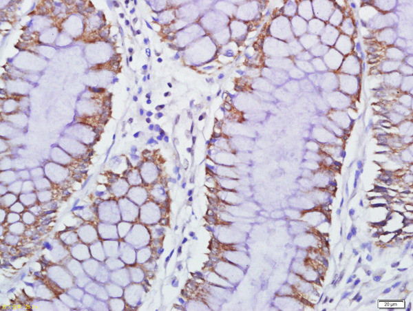 GPCR EX33 Antibody in Immunohistochemistry (Paraffin) (IHC (P))
