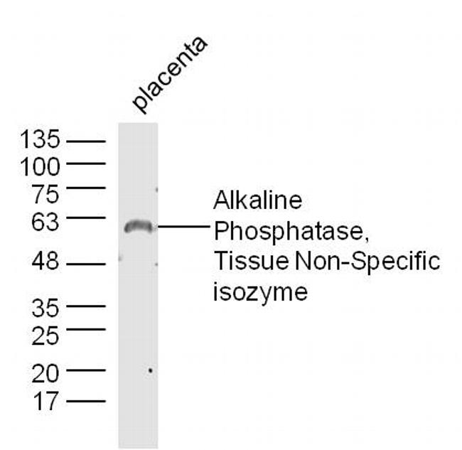 AP-TNAP/ALPL Antibody in Western Blot (WB)