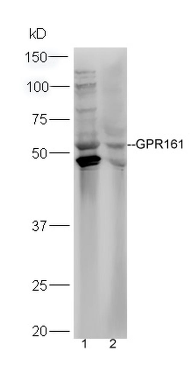 GPR161 Antibody in Western Blot (WB)
