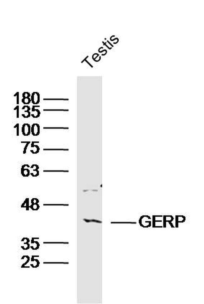 GPS2 Antibody in Western Blot (WB)