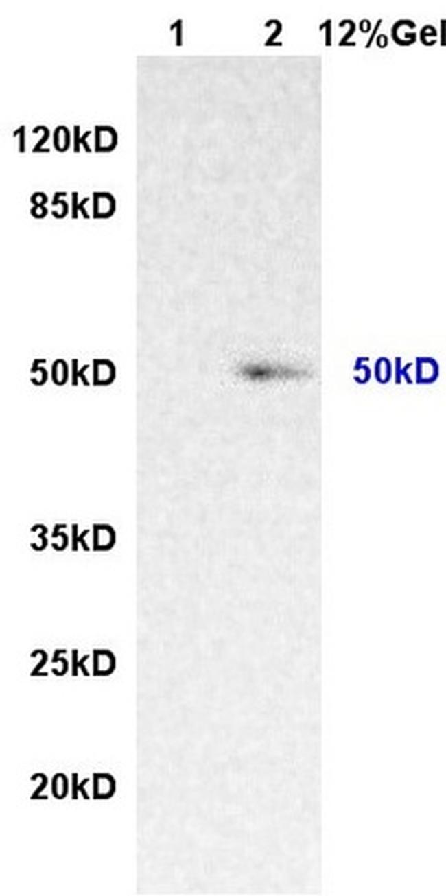 IL-7Ra/CD127 Antibody in Western Blot (WB)