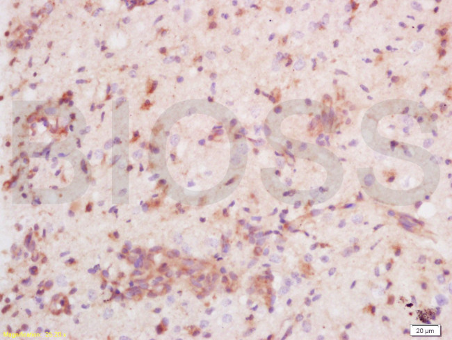 Heparanase Antibody in Immunohistochemistry (Paraffin) (IHC (P))