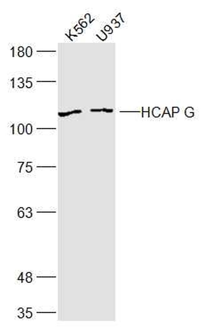HCAP G Antibody in Western Blot (WB)