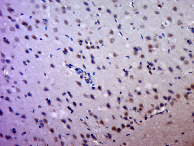 HCCS Antibody in Immunohistochemistry (Paraffin) (IHC (P))
