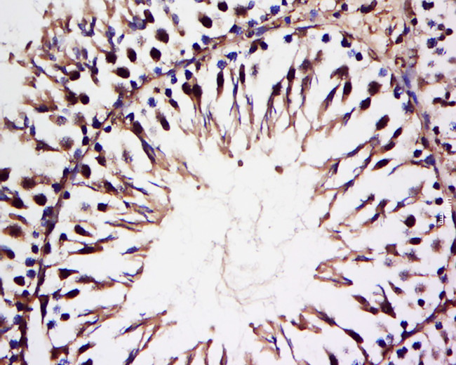 HECT E3 ubiquitin ligase Antibody in Immunohistochemistry (Paraffin) (IHC (P))