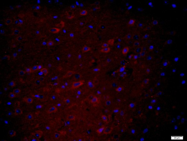 HEG1 Antibody in Immunohistochemistry (Paraffin) (IHC (P))