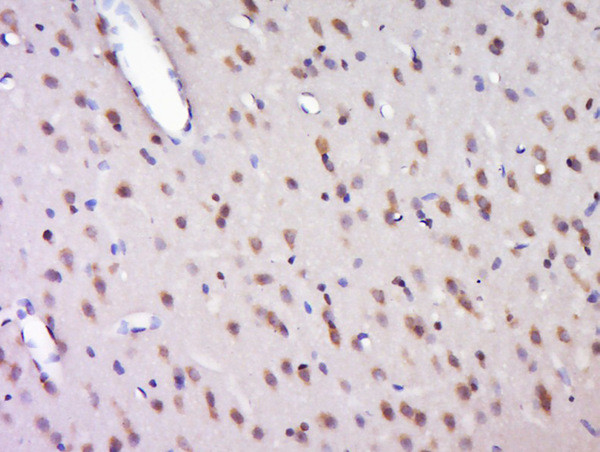 HELZ Antibody in Immunohistochemistry (Paraffin) (IHC (P))