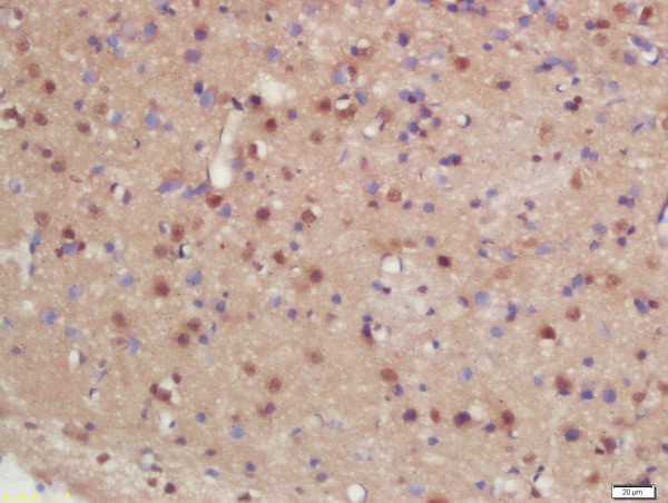 hHR23b Antibody in Immunohistochemistry (Paraffin) (IHC (P))