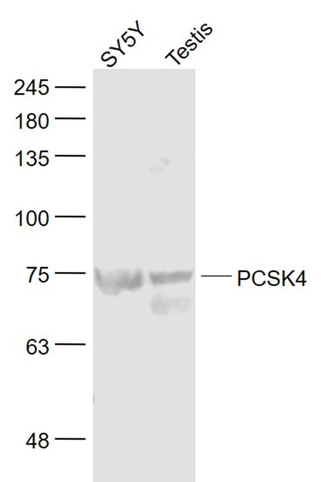 PCSK4 Antibody in Western Blot (WB)