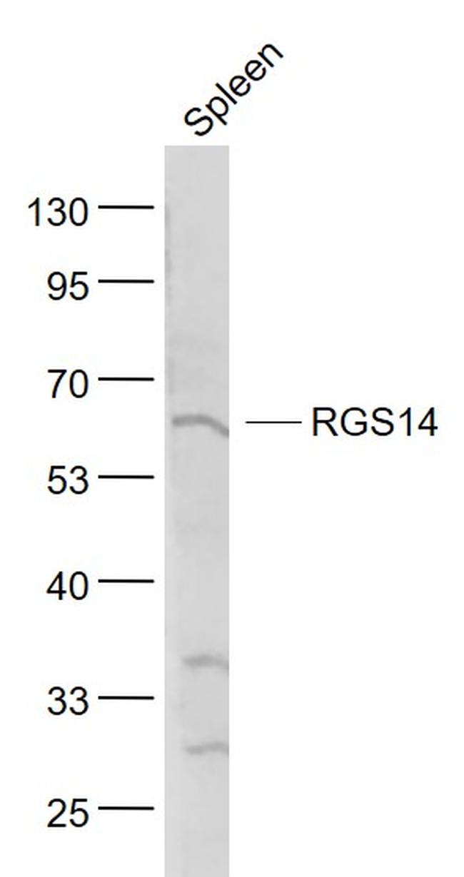 RGS14 Antibody in Western Blot (WB)
