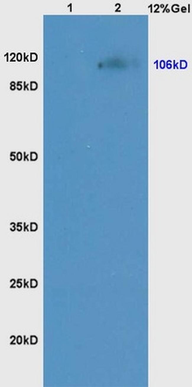 NCX1/SLC8A1 Antibody in Western Blot (WB)