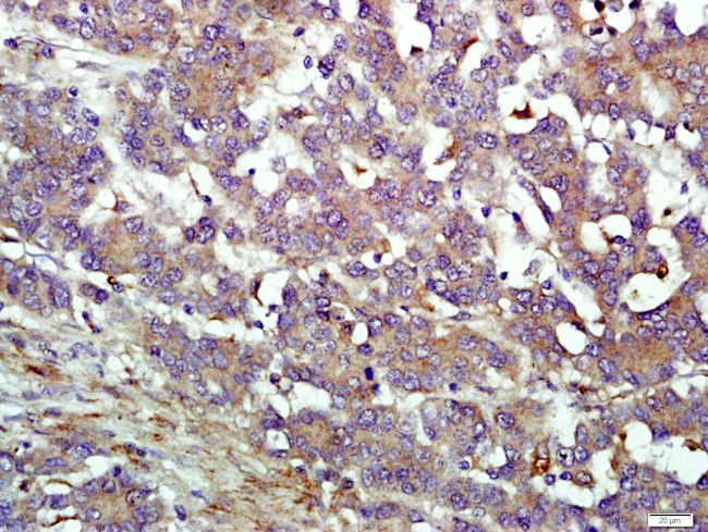 IFIT1B Antibody in Immunohistochemistry (Paraffin) (IHC (P))