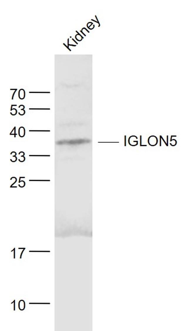 IGLON5 Antibody in Western Blot (WB)