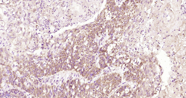 TEM8 Antibody in Immunohistochemistry (Paraffin) (IHC (P))