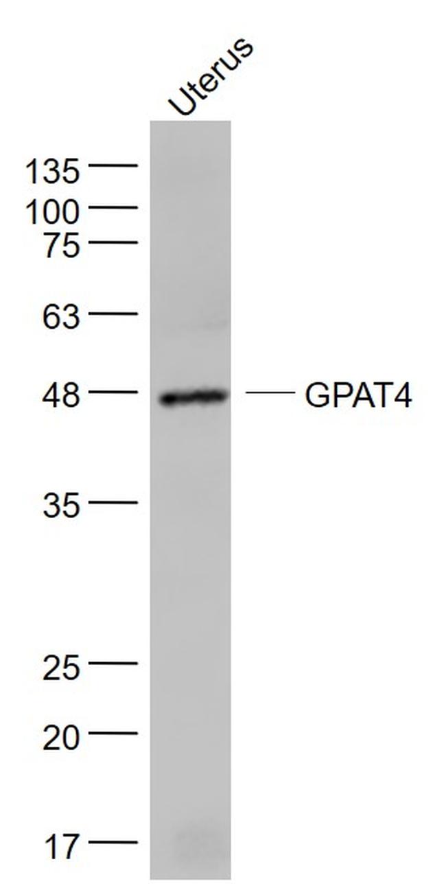 GPAT4 Antibody in Western Blot (WB)