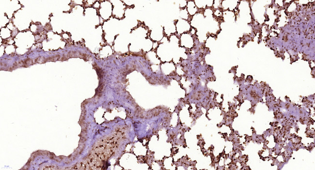 OAS2 Antibody in Immunohistochemistry (Paraffin) (IHC (P))
