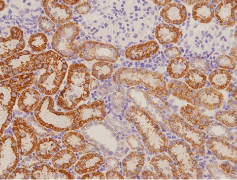 RAMP1 Antibody in Immunohistochemistry (Paraffin) (IHC (P))