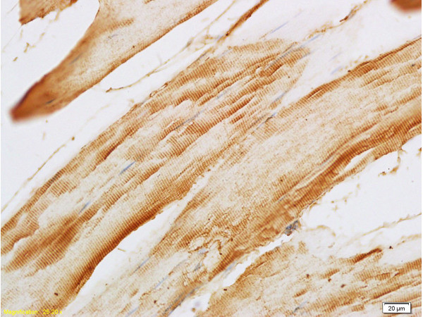 F-Actin Antibody in Immunohistochemistry (Paraffin) (IHC (P))