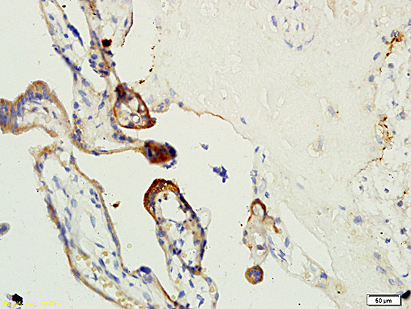 factor 13 Antibody in Immunohistochemistry (Paraffin) (IHC (P))