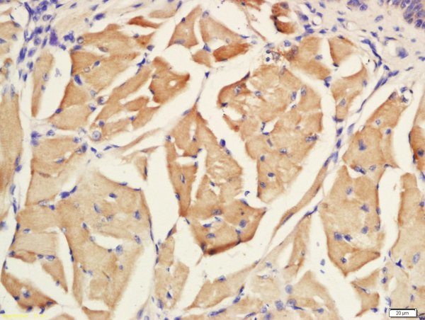 CK20 Antibody in Immunohistochemistry (Paraffin) (IHC (P))