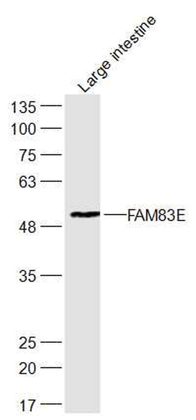 FAM83E Antibody in Western Blot (WB)