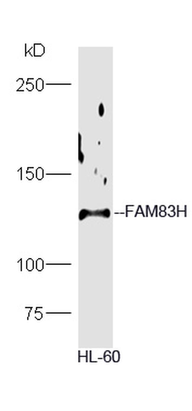 FAM83H Antibody in Western Blot (WB)