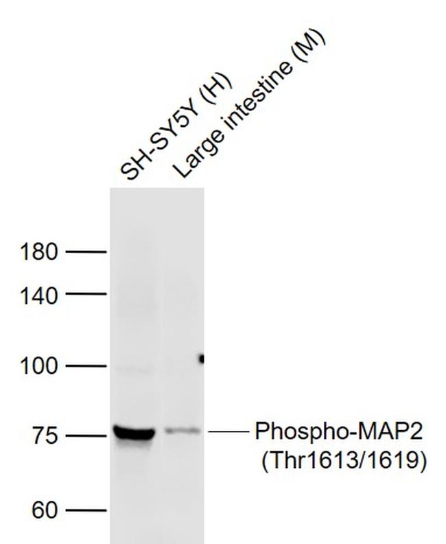 Phospho-MAP2 (Thr1613, 1619) Antibody in Western Blot (WB)