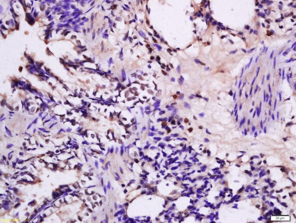 FKLF Antibody in Immunohistochemistry (Paraffin) (IHC (P))