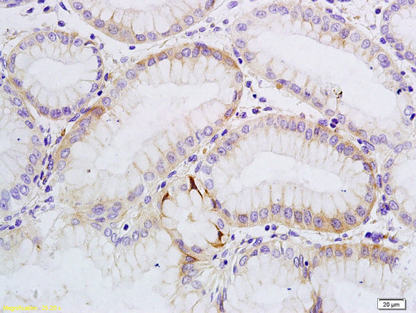 SATB1 Antibody in Immunohistochemistry (Paraffin) (IHC (P))