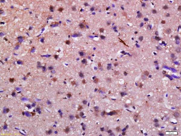 Syndetin Antibody in Immunohistochemistry (Paraffin) (IHC (P))