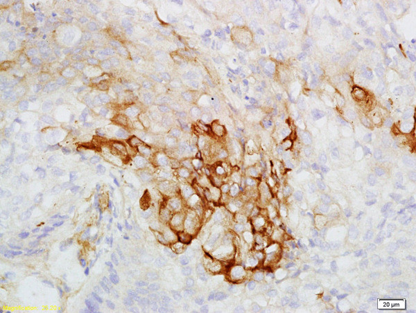 CK7 Antibody in Immunohistochemistry (Paraffin) (IHC (P))